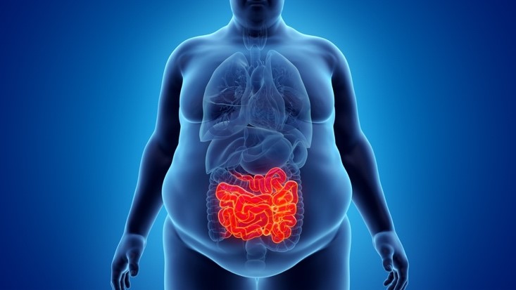 A 3D-rendered illustration of an obese man's small intestine.